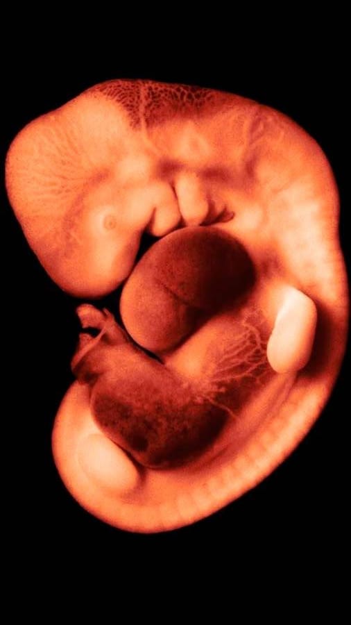 EMBRIOLOGÍA- Dr. Ayax Rizo 2do Parcial (Irregulares)