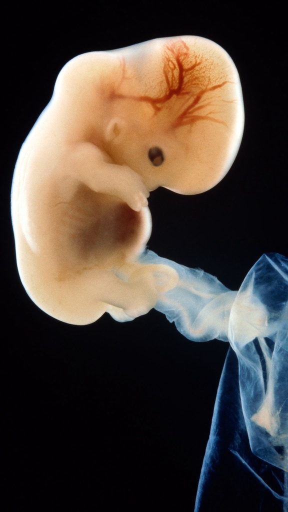 EMBRIOLOGÍA- Dr. Ayax Rizo CURSO INTERNACIONAL